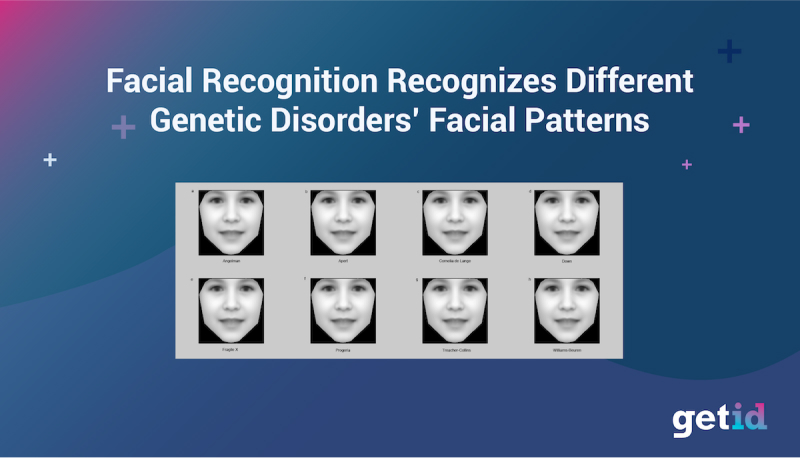 Facial recognition recognizes different genetic disorders facial patterns